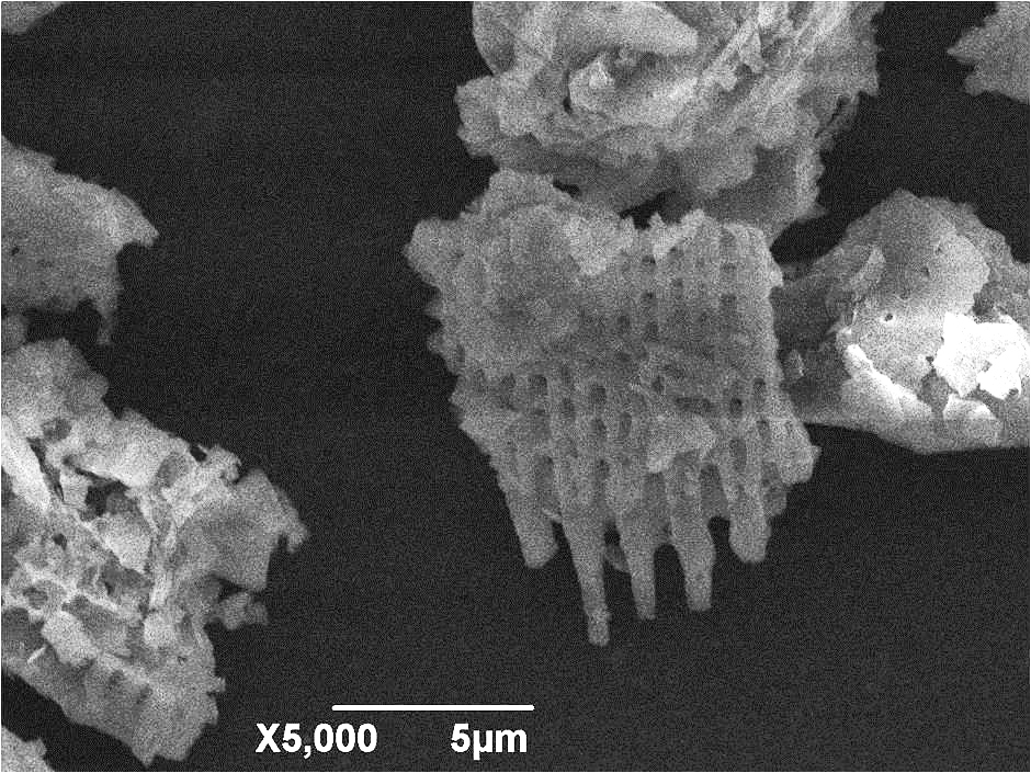 5000 X Magnification Of Silica Dust Particles